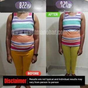 Reshma-before-after-pic
